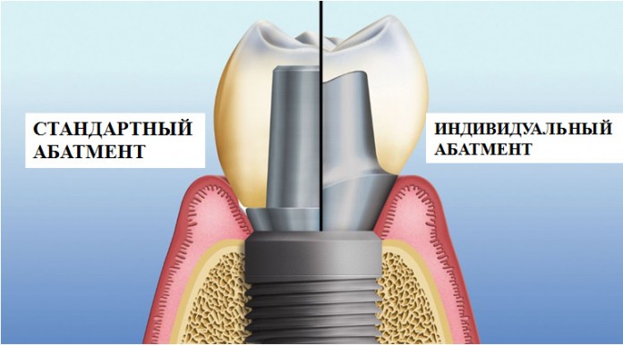 0_Page_41_Image_0004