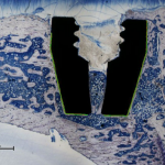 Figure-4-Histomorphometric-sample-with-a-PPAAm-coated-implant-in-the-proximal-rat-tibia