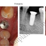 NI_Page_15