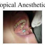 anestesia_Page_1_Image_0003