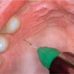 anestesia_Page_4_Image_0001
