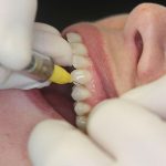 anestesia_Page_4_Image_0002